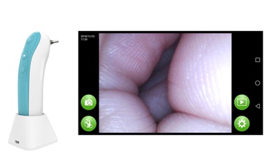 WIFI otoscope screenshot 3
