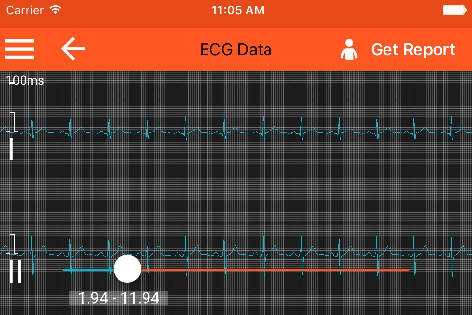 Spaulding ECG screenshot 3