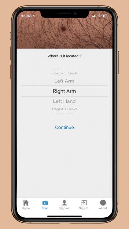 DermoScanner screenshot-3