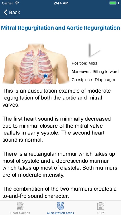 Heart Sounds Auscultation screenshot-5