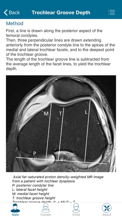 Radiology Measurements