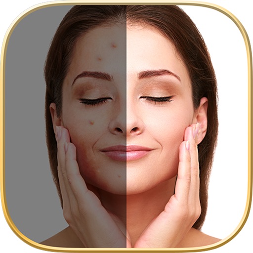 Blemish Editor - Pimple Eraser