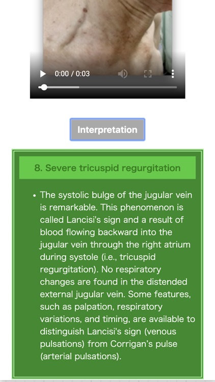 Pocket Heart Physical Exam screenshot-4