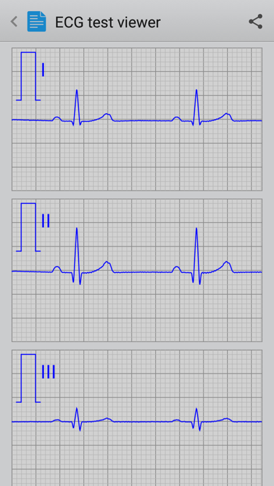 Istel ECG screenshot 3