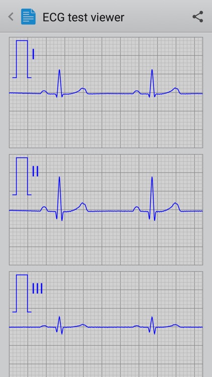 Istel ECG