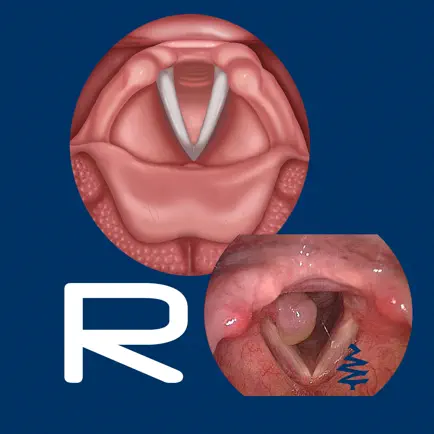 Vocal Pathology: Reflux Читы