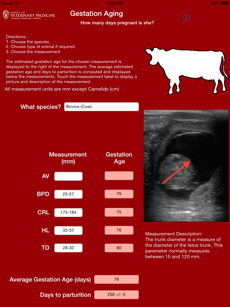 Gestation Aging screenshot 2