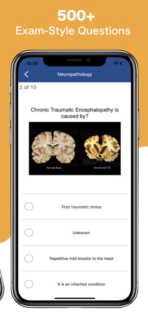 NEUROSURGERY Exam Prep 2020(圖2)-速報App