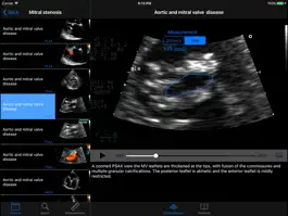 Game screenshot CARDIO3®Echocardiography HD hack