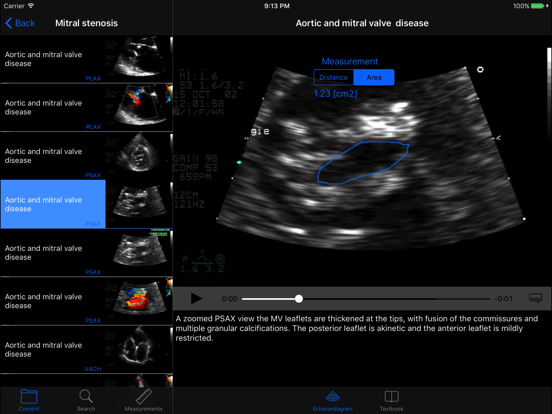 CARDIO3®Echocardiography HDのおすすめ画像3