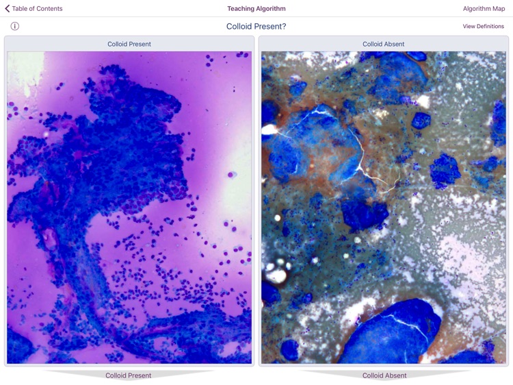 Thyroid Pathology screenshot-3