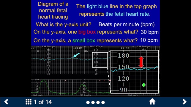 Fetal Heart Rate - SecondLook(圖2)-速報App