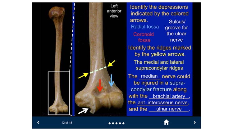 MSK Anatomy - SecondLook