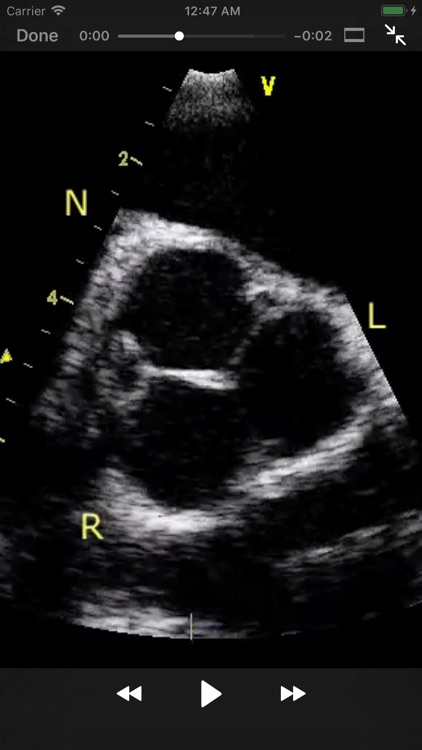 CARDIO3®Echocardiography screenshot-3