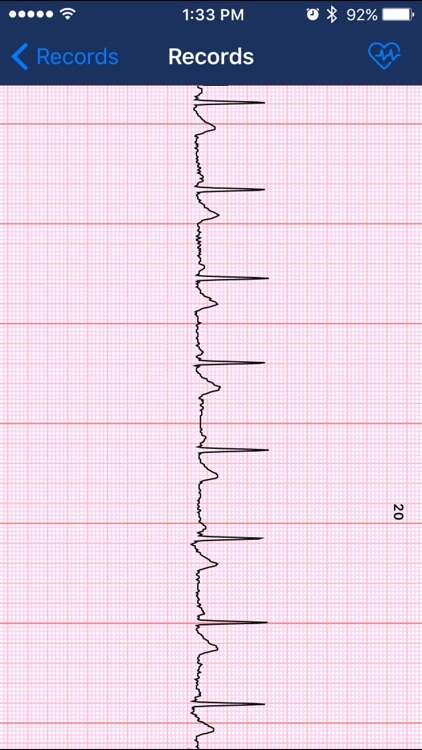 medel iBP ECG screenshot-3