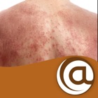 Top 9 Medical Apps Like Atopic Dermatitis @PoC - Best Alternatives