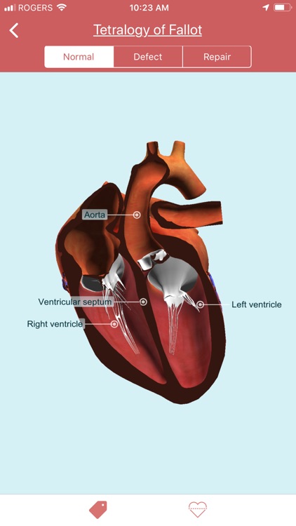 eMurmur Heartpedia