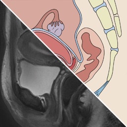 Radiology Simple Guide