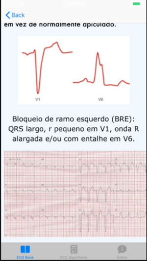 ECG Basico(圖2)-速報App