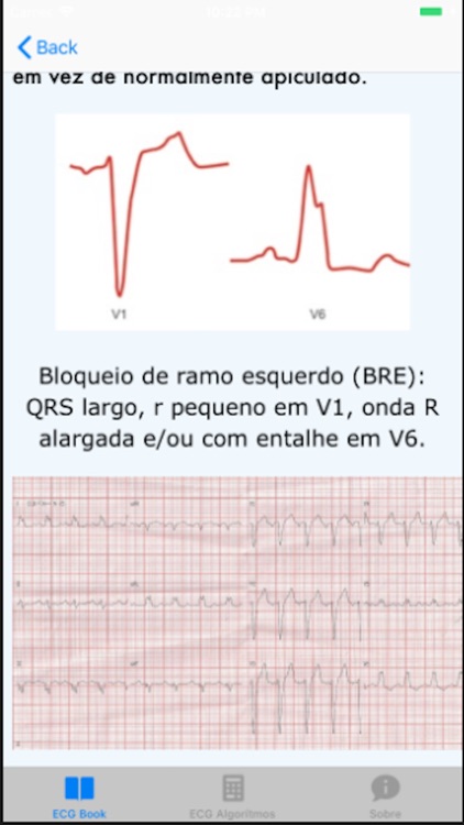 ECG Basico