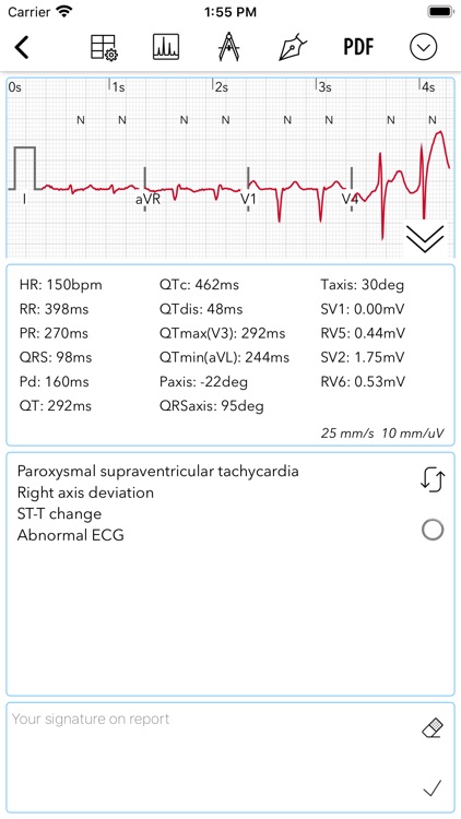 ECG Pro screenshot-4