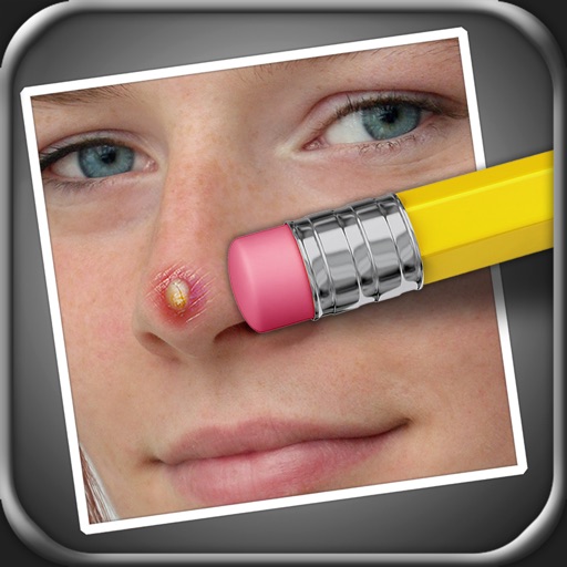 Pimple Eraser iOS App