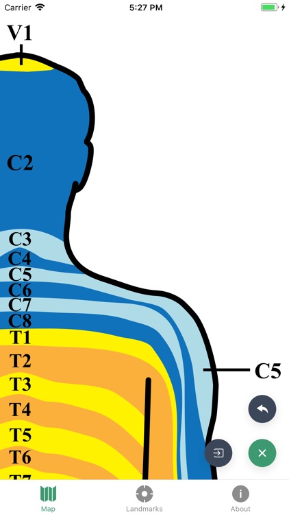 Dermatomes