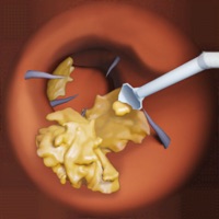 Endoscope cleaning ear Wiki