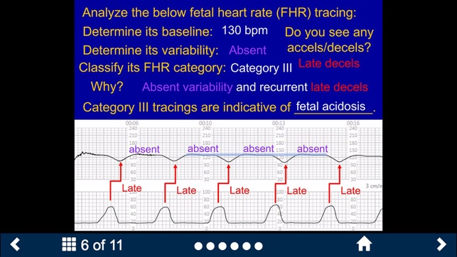 Fetal Heart Rate - SecondLook(圖5)-速報App