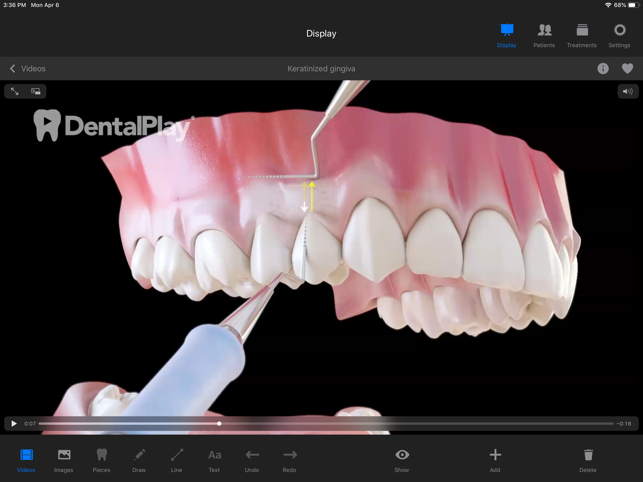 Dentool(圖2)-速報App