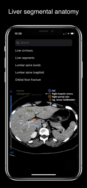 MAD Radiology