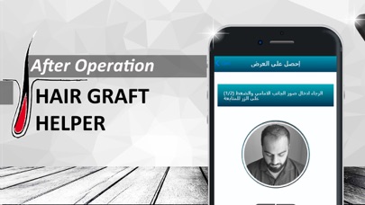 How to cancel & delete Hair Graft Helper from iphone & ipad 1