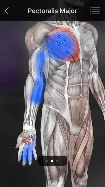 Muscle Trigger Points screenshot-3