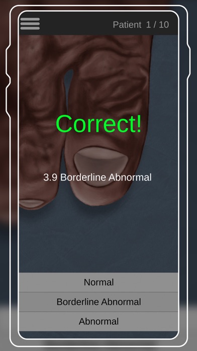 Capillary Refill Trainer screenshot 3