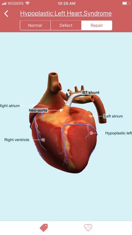 eMurmur Heartpedia screenshot-9