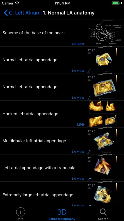 CARDIO3® 3D Echocardiography