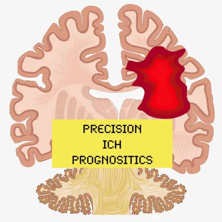 ICH Prognostics Читы