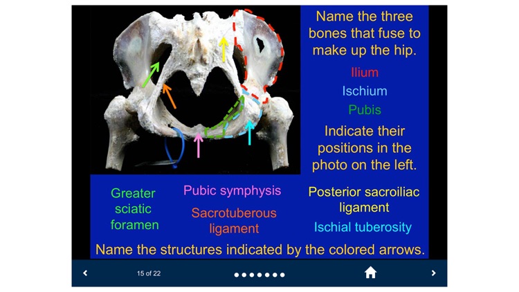 MSK Anatomy - SecondLook screenshot-4