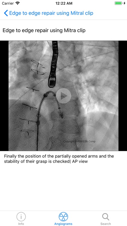 CARDIO3® Interventional Atlas screenshot-3