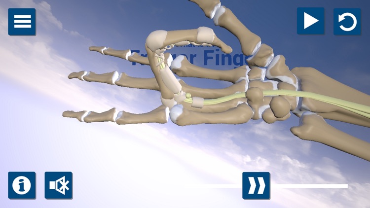 Trigger Finger 3D