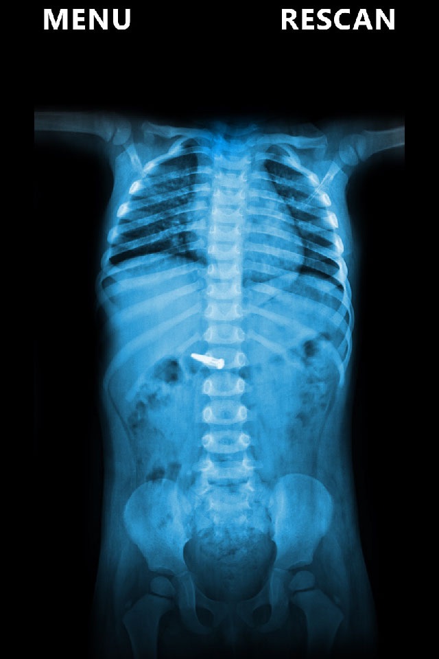 X-Ray Scanner Body Prank screenshot 2