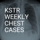 Top 29 Medical Apps Like KSTR Weekly Chest Cases - Best Alternatives