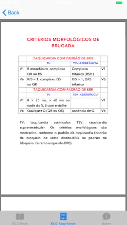 ECG Basico screenshot-4