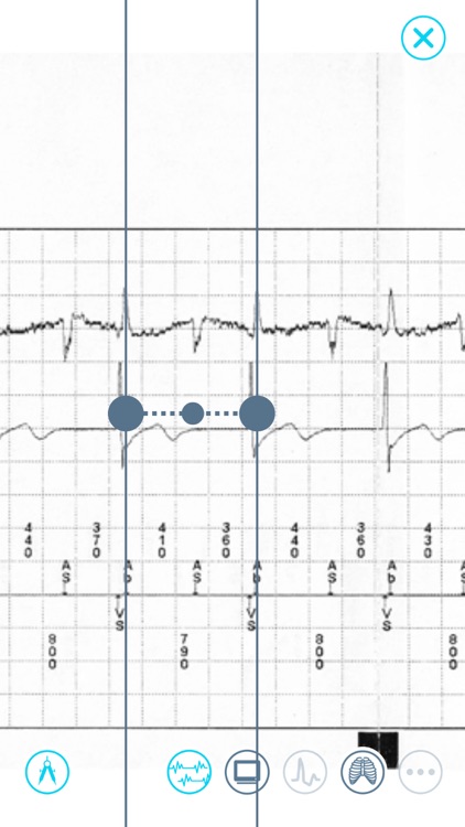 Cardiac Device Challenge screenshot-4