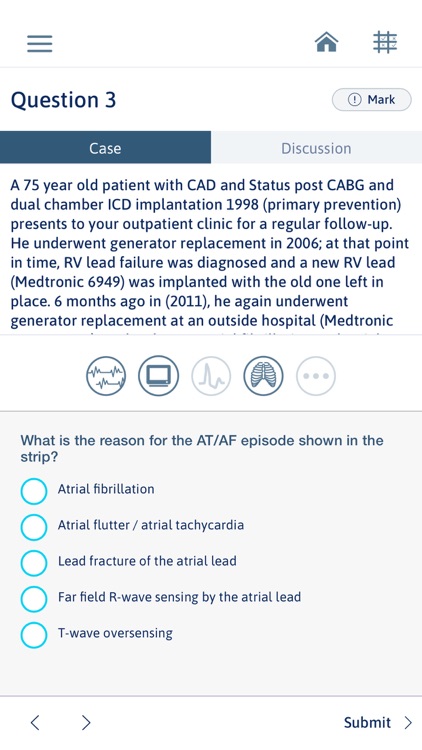 Cardiac Device Challenge