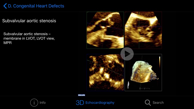 CARDIO3® 3D Echocardiography screenshot-4