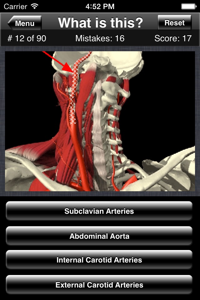 Anatomy Spine Quiz screenshot 4