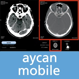 aycan mobile