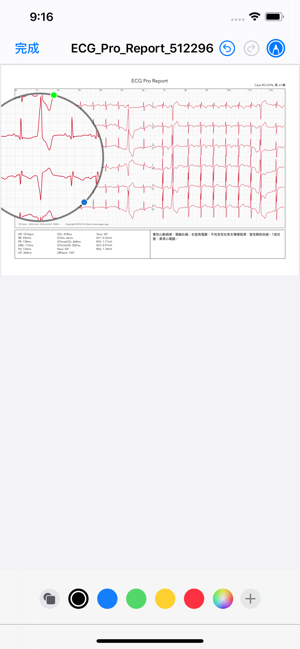 ECG / EKG(圖7)-速報App