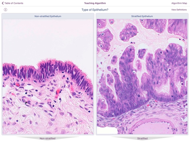 Ovarian Tumor Pathology(圖4)-速報App